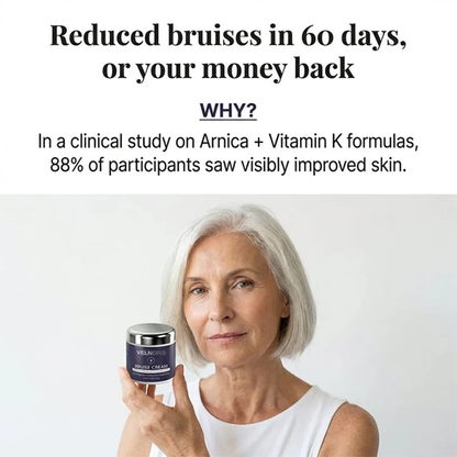 ✨👩‍⚕️VELNORS® Bruise Repair & Skin-Strengthening Cream-Advanced daily care for bruise-prone skin