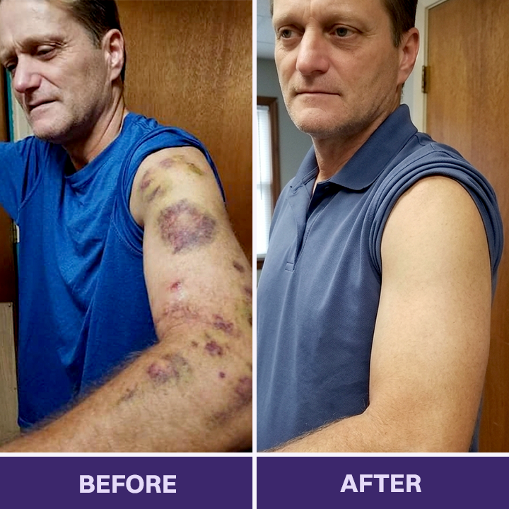 ✨👩‍⚕️VELNORS® Bruise Repair & Skin-Strengthening Cream-Advanced daily care for bruise-prone skin